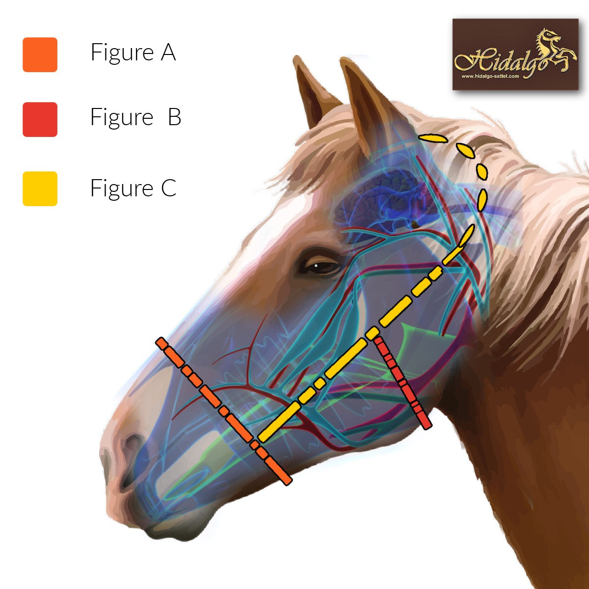 Hidalgo Multibridle St. Louis-WA CLINIC SPECIAL